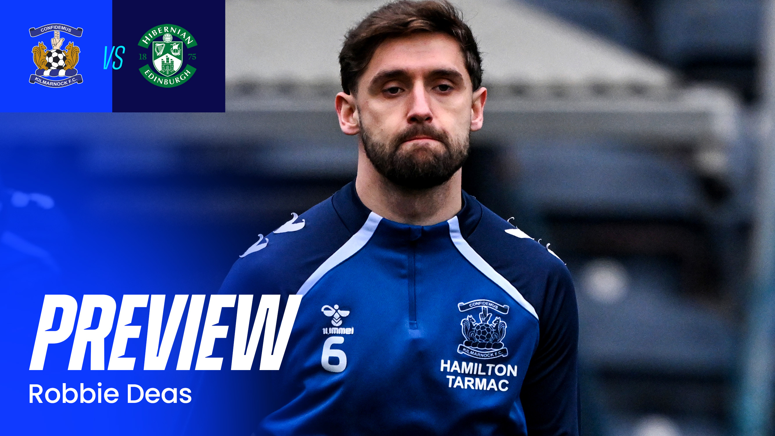 Hibernian Preview: Robbie Deas
